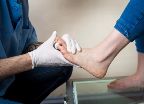 Ankle Sprain - Treatment and Therapy Options in Bramton